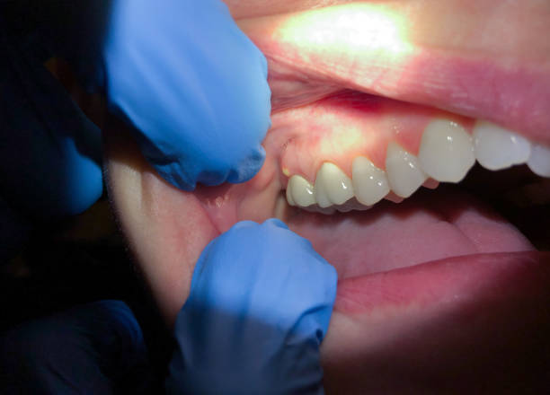 Best Walk-In Emergency Dentist in Vineland, NJ